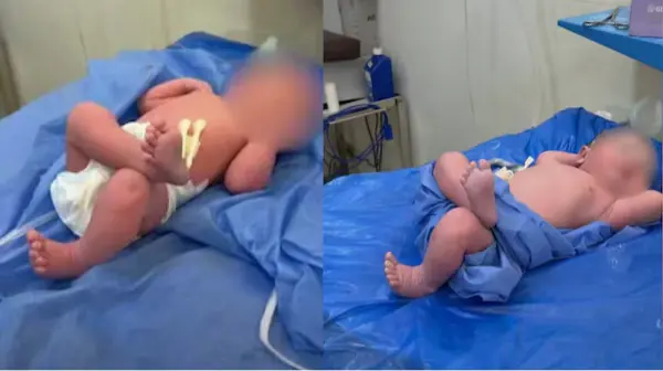 जन्म लेते ही अनोखे अंदाज में लेटा नवजात, वीडियो वायरल